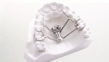 Model smile with palatal expander