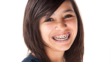 Teen girl with braces in Webster
