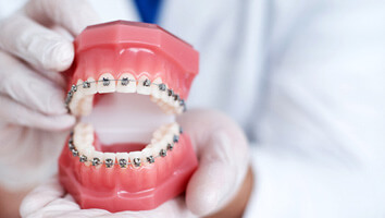 dentist holding teeth with braces