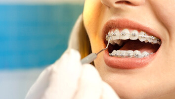 patient with braces smiling while visiting dentist