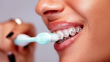 Closeup of woman brushing her braces in Rochester