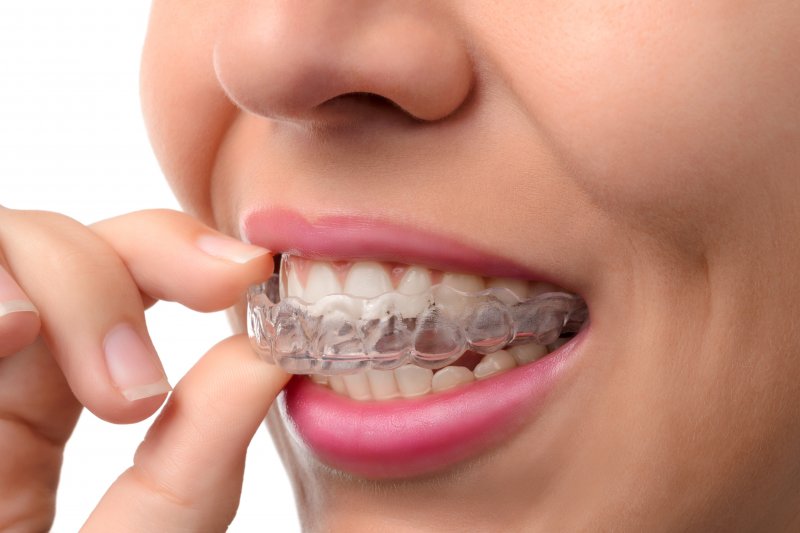 Invisalign retainer