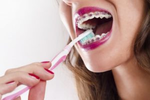 Woman brushing her braces