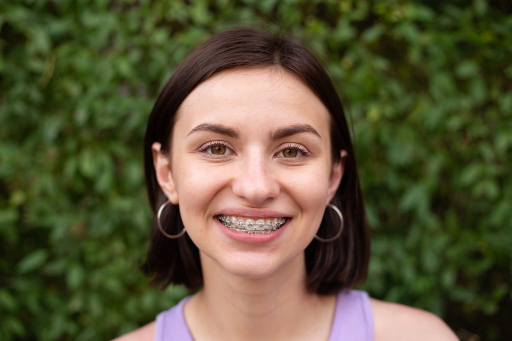 Closeup of woman with braces smiling