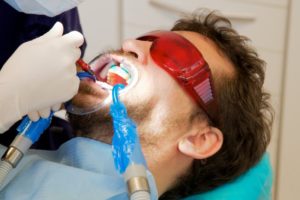 man getting teeth whitening