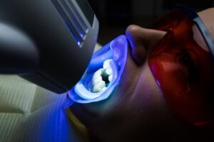 Patient receiving teeth whitening treatment.